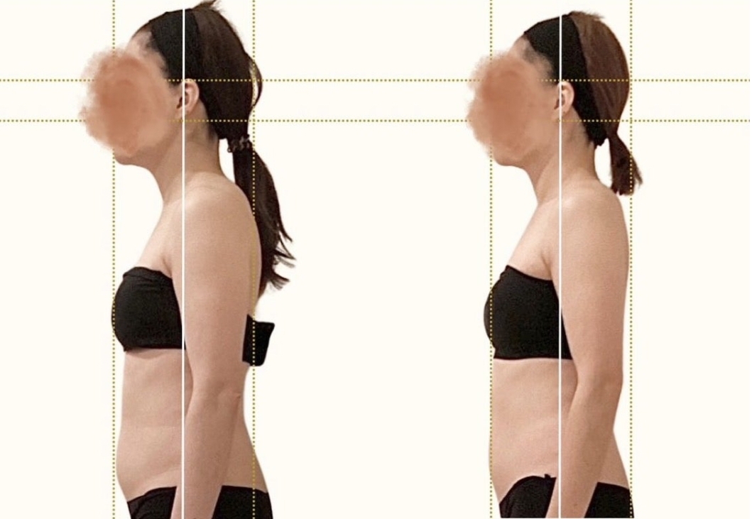 美禅の施術前後の画像