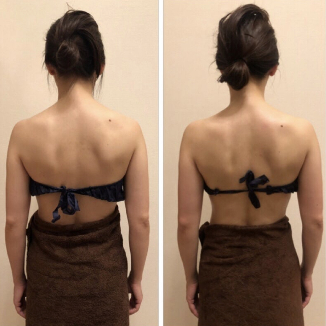 美禅の施術前後の画像