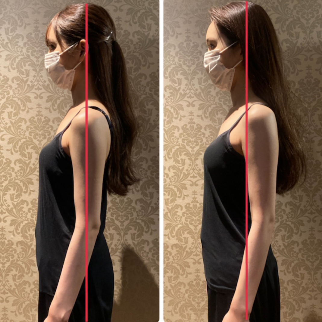 美禅の施術前後の画像