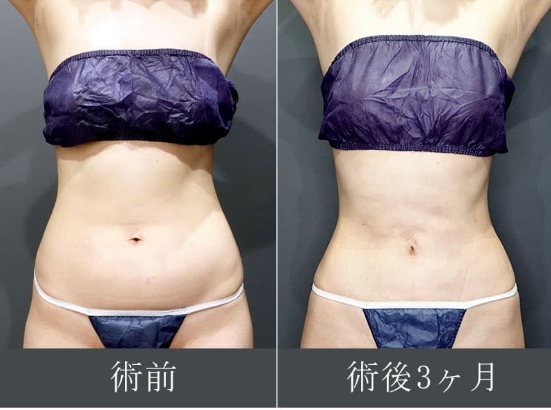 美禅の施術前後の画像