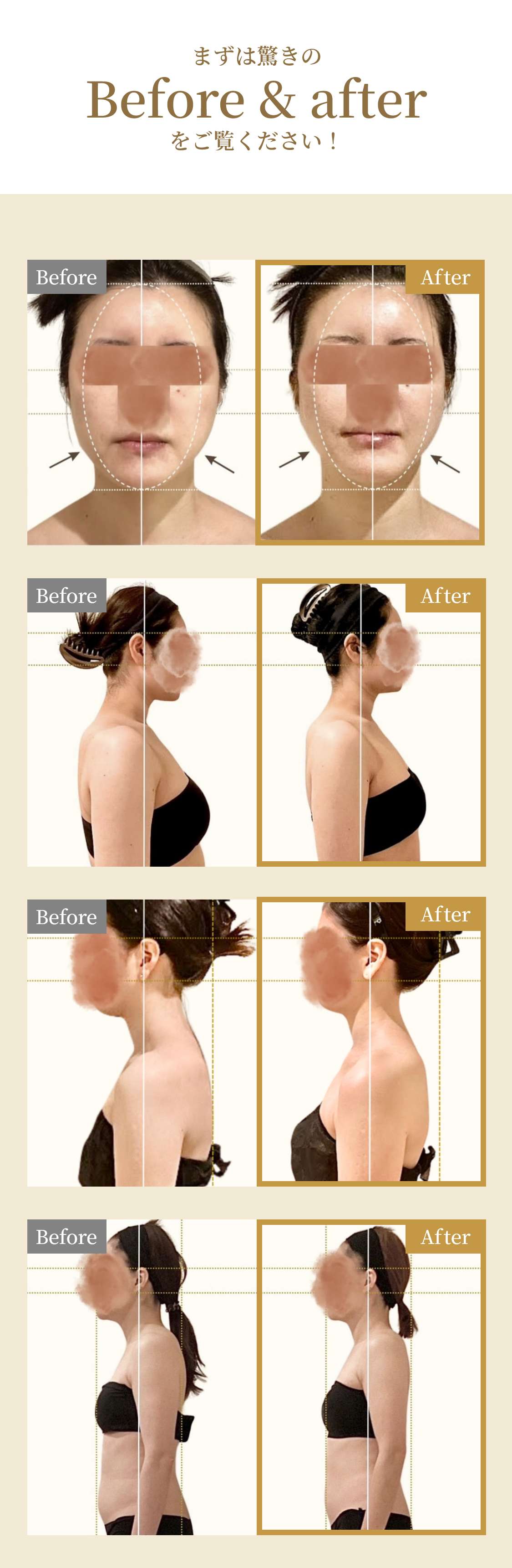 美禅のビフォーアフターセクション