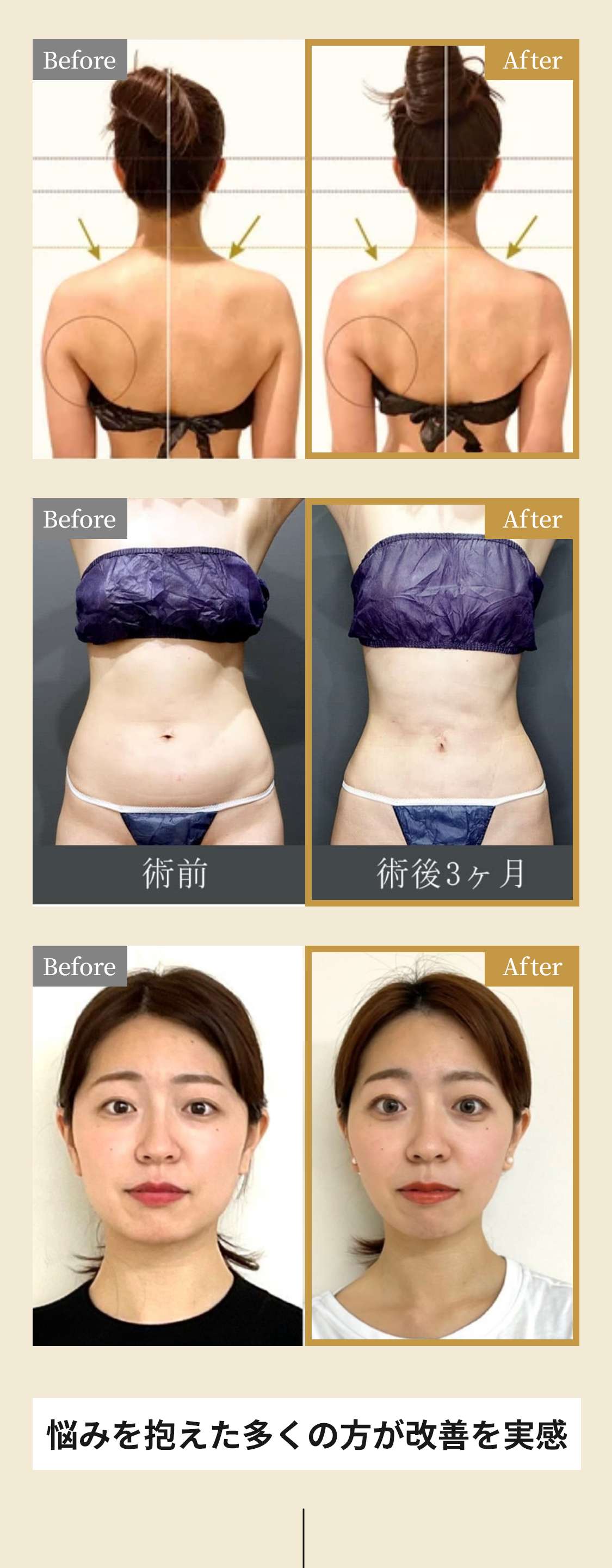 美禅のビフォーアフターセクション